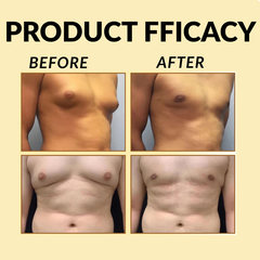 Lipo Therm Bee Venom Gynecomastia Heating Oil